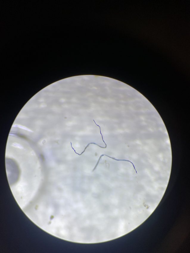 Polyester Fabric in Fish Polyester fabric found in Bahamian fish.